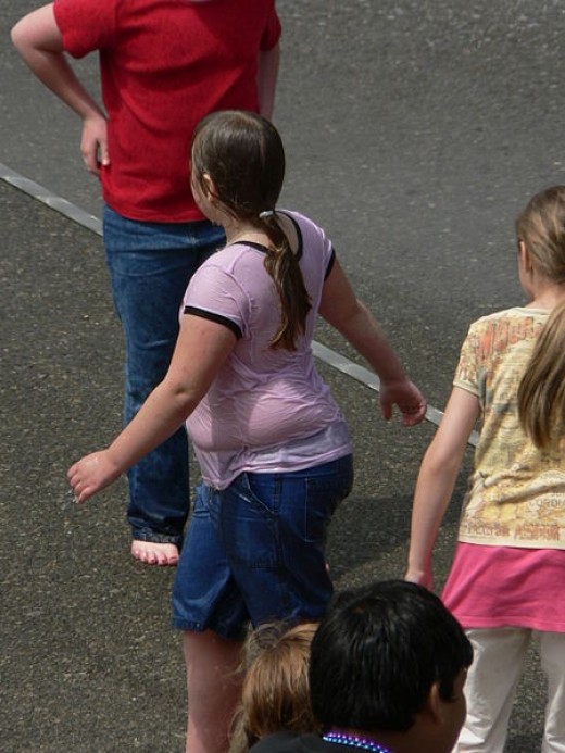 Obesity in children is a world-wide problem