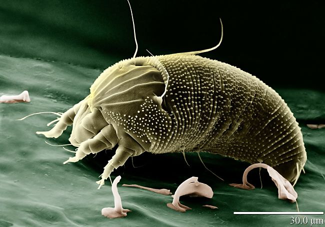 Dust mites can get worse in winter because the house is closed up and there is extra humidity