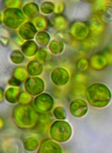 Tiny single cells of Chlorella - Learn more about this alga here