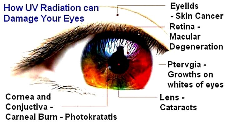 Discover how sun exposure damages your eyes and how to prevent and treat the symptoms to minimize the impact