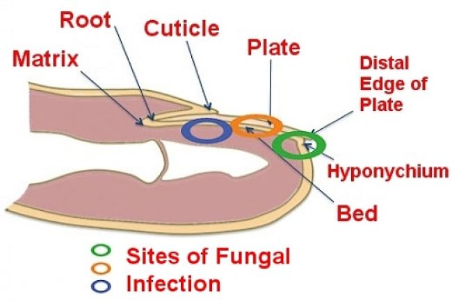Major Sites of Fungal Infection and Types