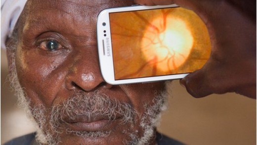 An attachment to a smartphone can use the flash to take pictures at the back of the eye to check for diseases and health of the retina