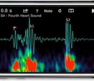 Smartphones for diagnosis and monitoring