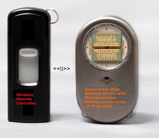 The implantable drug delivery device is programmed by the wireless control unit to deliver drugs via a group of 'wells' within the device. The delivery can be made using a schedule or in response to body signals. Various models are available.